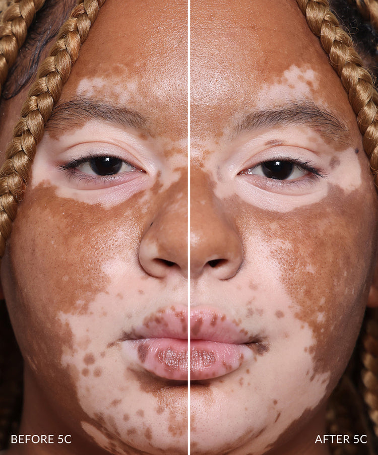 Concealer
