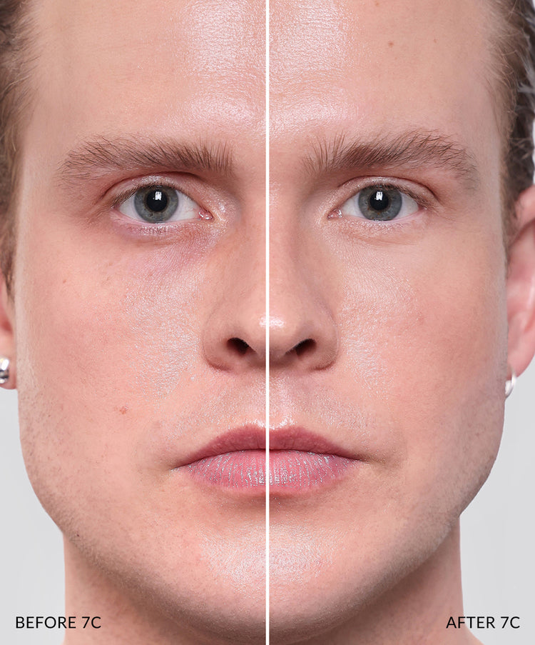 Concealer