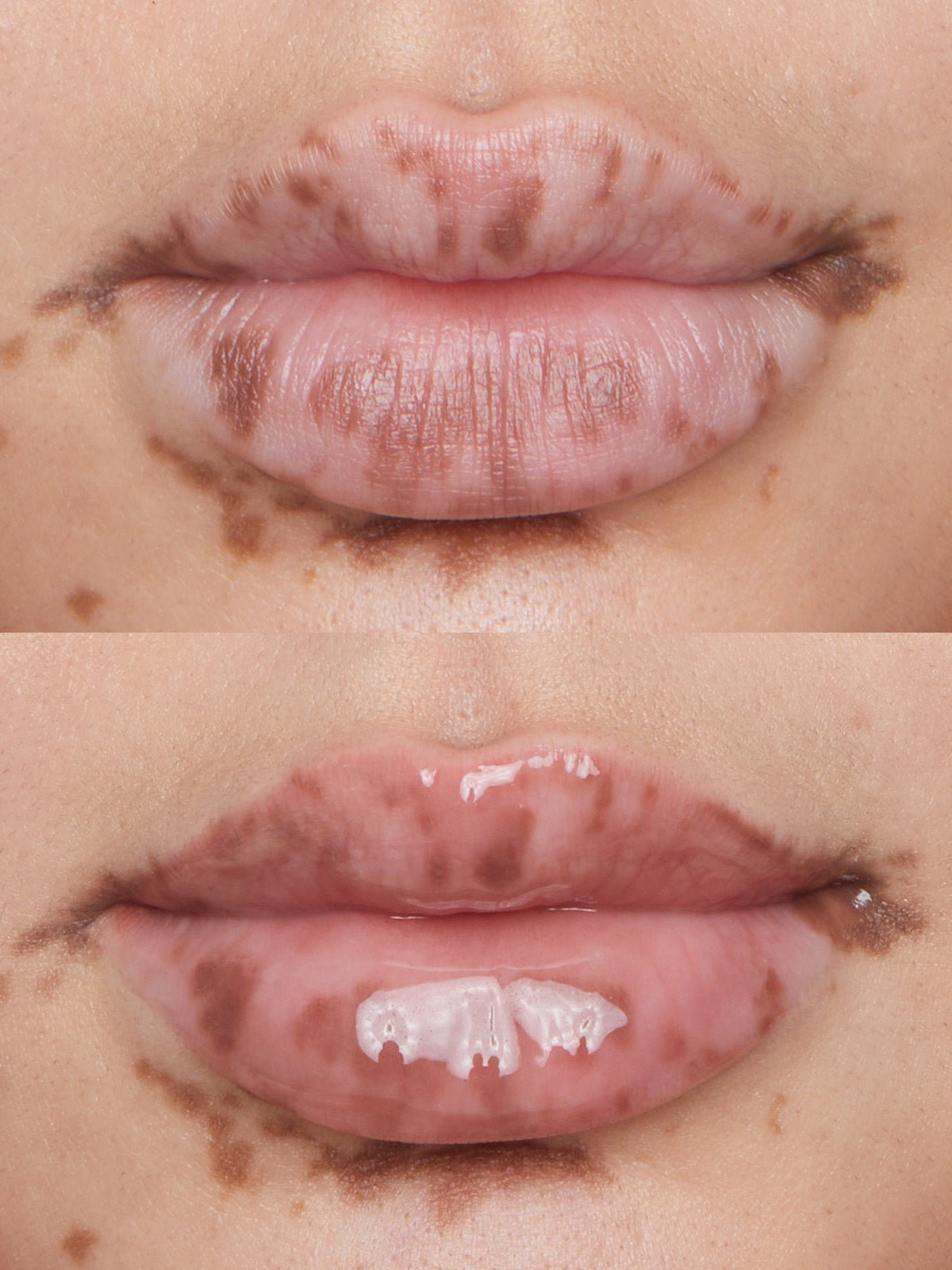 LIPS BEFORE AND AFTER REFY LIP GLOSS